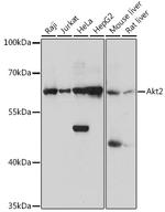 AKT2 Antibody in Western Blot (WB)