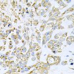 HDAC3 Antibody in Immunohistochemistry (Paraffin) (IHC (P))