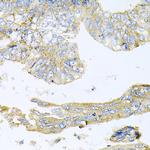 HDAC3 Antibody in Immunohistochemistry (Paraffin) (IHC (P))