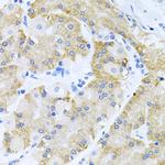 HDAC3 Antibody in Immunohistochemistry (Paraffin) (IHC (P))