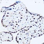 SAFB2 Antibody in Immunohistochemistry (Paraffin) (IHC (P))