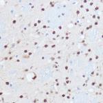 SAFB2 Antibody in Immunohistochemistry (Paraffin) (IHC (P))