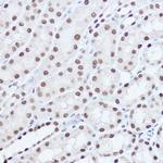 SAFB2 Antibody in Immunohistochemistry (Paraffin) (IHC (P))