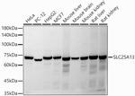 SLC25A13 Antibody in Western Blot (WB)