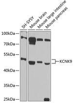 KCNK9 Antibody in Western Blot (WB)