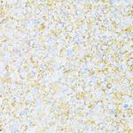 UCRC Antibody in Immunohistochemistry (Paraffin) (IHC (P))