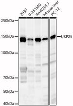 USP25 Antibody in Western Blot (WB)