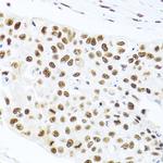 PRP19 Antibody in Immunohistochemistry (Paraffin) (IHC (P))