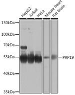 PRP19 Antibody in Western Blot (WB)