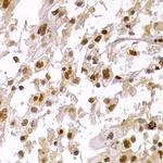 HP1 alpha Antibody in Immunohistochemistry (Paraffin) (IHC (P))