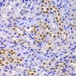 HP1 alpha Antibody in Immunohistochemistry (Paraffin) (IHC (P))