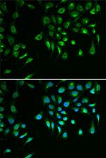 Livin Antibody in Immunocytochemistry (ICC/IF)