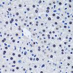 Livin Antibody in Immunohistochemistry (Paraffin) (IHC (P))