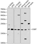 hCG beta-7 Antibody in Western Blot (WB)