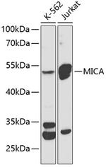 MICA Antibody in Western Blot (WB)