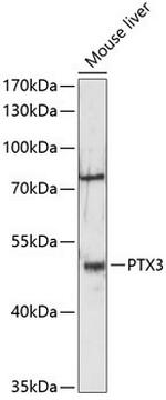 PTX3 Antibody in Western Blot (WB)