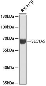 ASCT2 Antibody in Western Blot (WB)