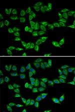 PRDX5 Antibody in Immunocytochemistry (ICC/IF)