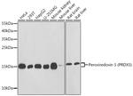 PRDX5 Antibody in Western Blot (WB)