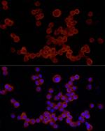 NLRP3 Antibody in Immunocytochemistry (ICC/IF)