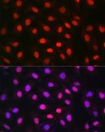 MDC1 Antibody in Immunocytochemistry (ICC/IF)