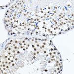 MDC1 Antibody in Immunohistochemistry (Paraffin) (IHC (P))