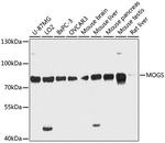 GCS1 Antibody in Western Blot (WB)