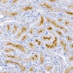 ACE2 Antibody in Immunohistochemistry (Paraffin) (IHC (P))