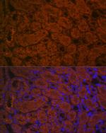 ACE2 Antibody in Immunohistochemistry (Paraffin) (IHC (P))