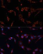 PDIA2 Antibody in Immunocytochemistry (ICC/IF)