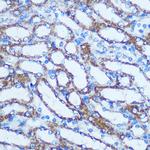 GSTT1 Antibody in Immunohistochemistry (Paraffin) (IHC (P))