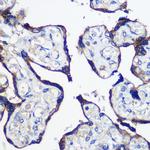 Parp8 Antibody in Immunohistochemistry (Paraffin) (IHC (P))