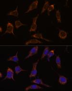 SCGN Antibody in Immunocytochemistry (ICC/IF)