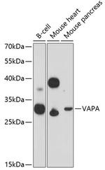 VAPA Antibody in Western Blot (WB)