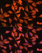 PITPN Antibody in Immunocytochemistry (ICC/IF)