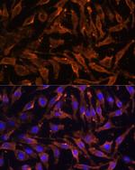 RANK Antibody in Immunocytochemistry (ICC/IF)