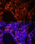 Neutrophil elastase Antibody in Immunocytochemistry (ICC/IF)