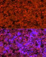 Neutrophil elastase Antibody in Immunocytochemistry (ICC/IF)