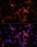 Neutrophil elastase Antibody in Immunocytochemistry (ICC/IF)