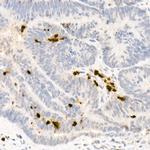 Neutrophil elastase Antibody in Immunohistochemistry (Paraffin) (IHC (P))