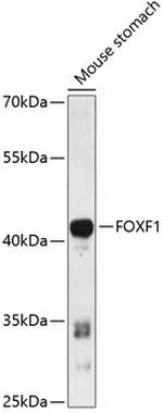 FOXF1 Antibody in Western Blot (WB)