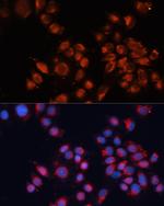 IGF2R Antibody in Immunocytochemistry (ICC/IF)