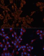 IGF2R Antibody in Immunocytochemistry (ICC/IF)