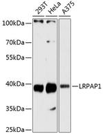 RAP Antibody in Western Blot (WB)