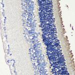 S-arrestin Antibody in Immunohistochemistry (Paraffin) (IHC (P))