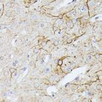 TBCA Antibody in Immunohistochemistry (Paraffin) (IHC (P))