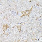 TBCA Antibody in Immunohistochemistry (Paraffin) (IHC (P))