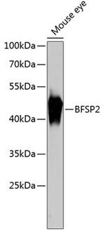 BFSP2 Antibody in Western Blot (WB)