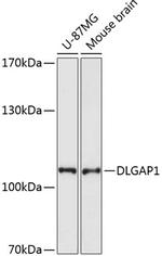 SAPAP1 Antibody in Western Blot (WB)