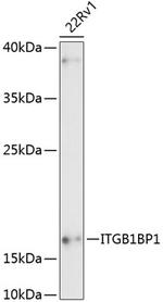 ITGB1BP1 Antibody in Western Blot (WB)